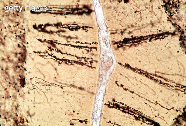 Cerebellar cortex. Bergmann glia (1705723855) - 게티이미지뱅크