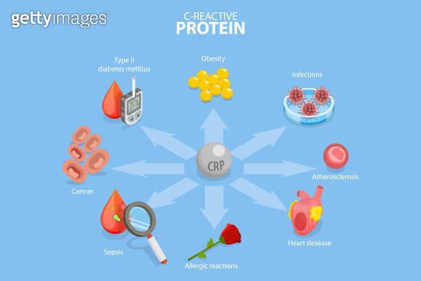 3D Isometric Flat Vector Conceptual Illustration of C-reactive Protein ...