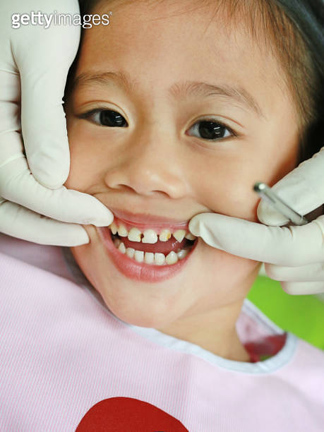Close-up little girl during dental extraction. Child with a teeth ...