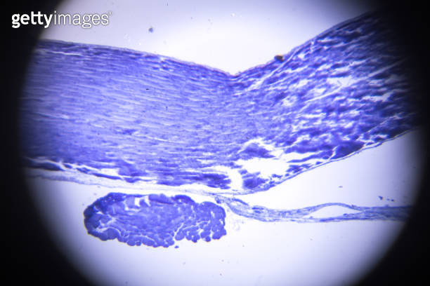 skeletal muscle longitudinal section in microscopy (666641022) 일러스트, 무료 ...