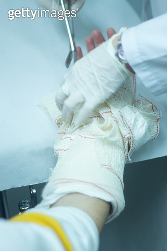 Doctor applying a plaster cast and bandages to patient forearm and ...