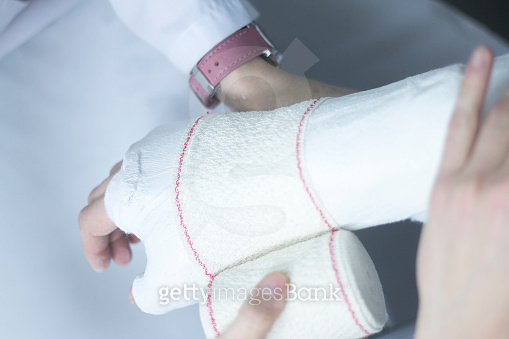 Doctor applying a plaster cast and bandages to patient forearm and ...