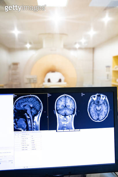 Monitor Scan Magnetic Resonance Head Scan Images on Computer Monitor While Scanning ...