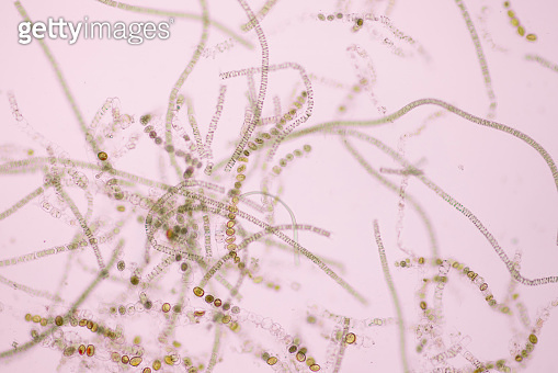 Filamentous algae are single algae cells that form long visible chains ...