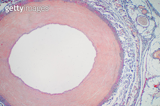 Artery blood vessel under microscope view for education histology ...