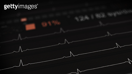 ECG waves on medical monitor rendering with DOF 이미지 (946355528) - 게티이미지뱅크
