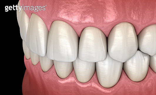 Healthy human teeth with normal occlusion, side view. Medically ...