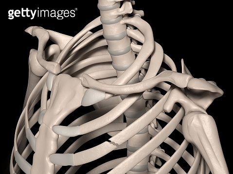 Fracture of 3rd rib (true rib) (1135951731) 일러스트, 무료 일러스트 - 게티이미지뱅크