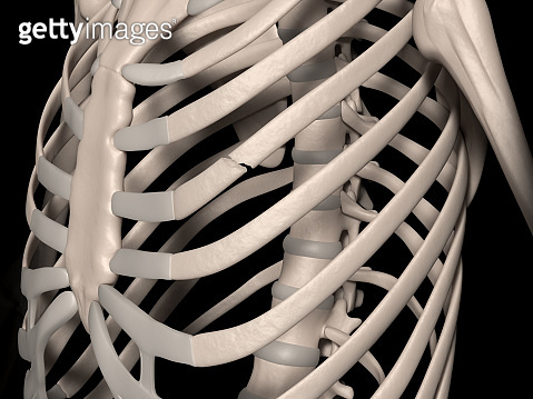 Fracture of 4th rib (true rib) (1135949866) 일러스트, 무료 일러스트 - 게티이미지뱅크