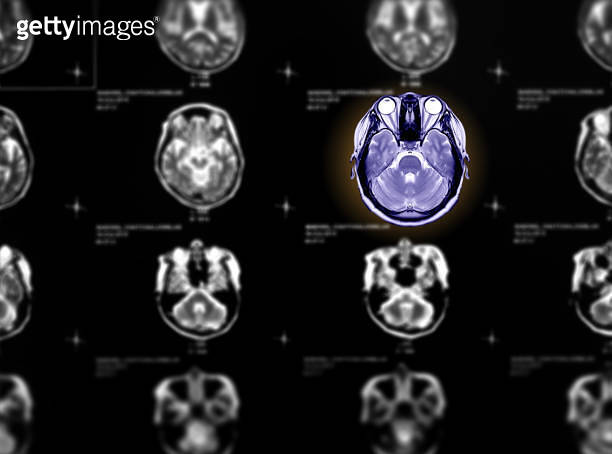 Structral Mri Background Selective focus of MRI brain axial view on blurred mri brain axial ...