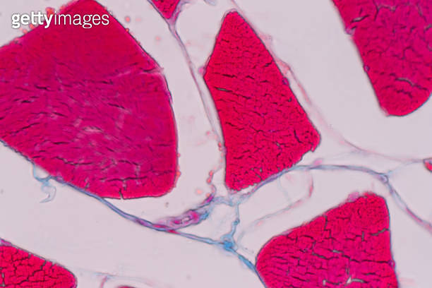 Education anatomy and Histological sample Striated muscle Tissue under ...
