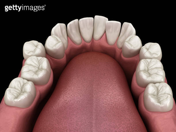 Abnormal teeth position, orthodontic concept. Medically accurate tooth ...