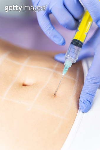 Patient undergoing a non-surgical fat reduction procedure (1224799089 ...