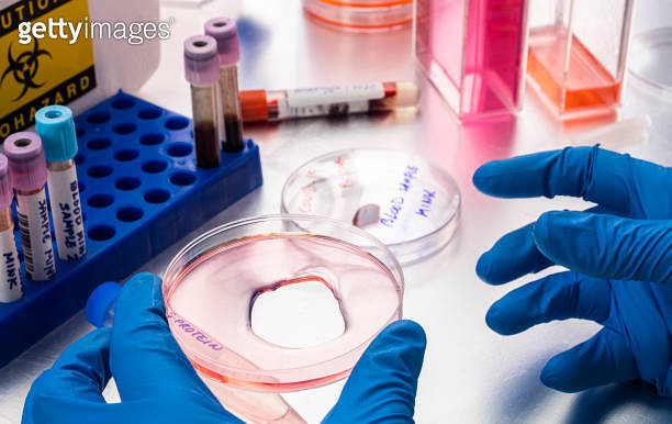Lab Sample Disk Scientist researching petri-disk S-protein samples in a laboratory ...