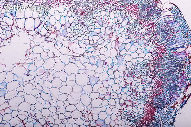 Zygomycota, or zygote fungi ,Downy mildew of cruzifers host tissue with ...