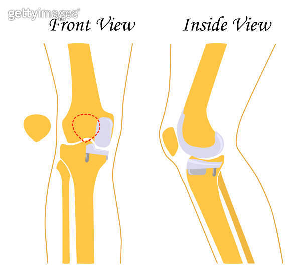 Front Rise Knee Human knee leg front and back view. Vector illustration. Flat design ...