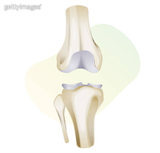 Knee Cartilage Injury Illustration 이미지 (1333707016) 게티이미지뱅크
