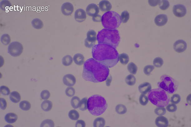 Immature and mature white blood cells.Segmented neutrophil,blast cells ...
