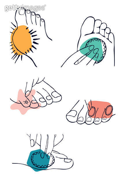 Common feet affections illustration set in graphic style, black and ...