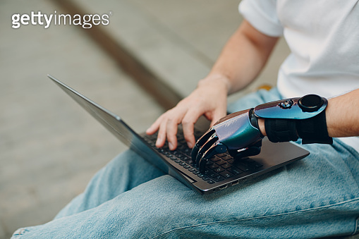 Young disabled man with artificial prosthetic hand using typing on ...