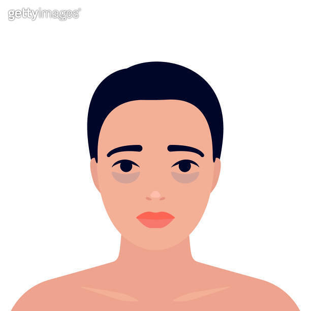 Young tired exhausted sleepy woman with pouches under eyes on her face