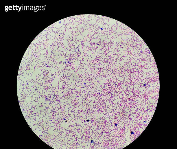 Escherichia coli, also known as E. coli, is a Gram-negative ...