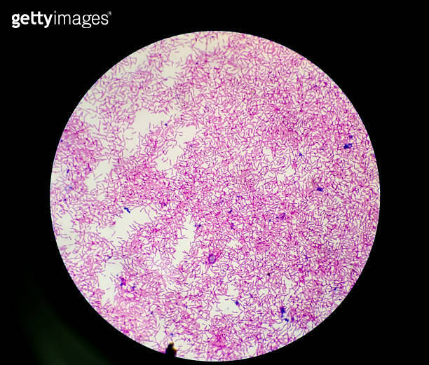 Escherichia coli, also known as E. coli, is a Gram-negative ...