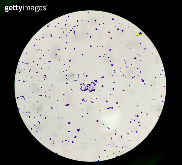 Colonies gram stain under 100x light microscope show gram positive