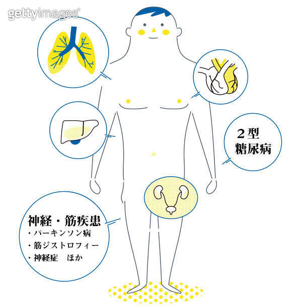 Explanatory diagram of basic diseases in full swing 이미지 (1300075876