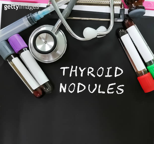 Thyroid Nodules word, medical term word with medical concepts in