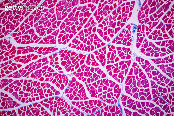 Histological sample Striated (Skeletal) muscle of mammal Tissue under ...