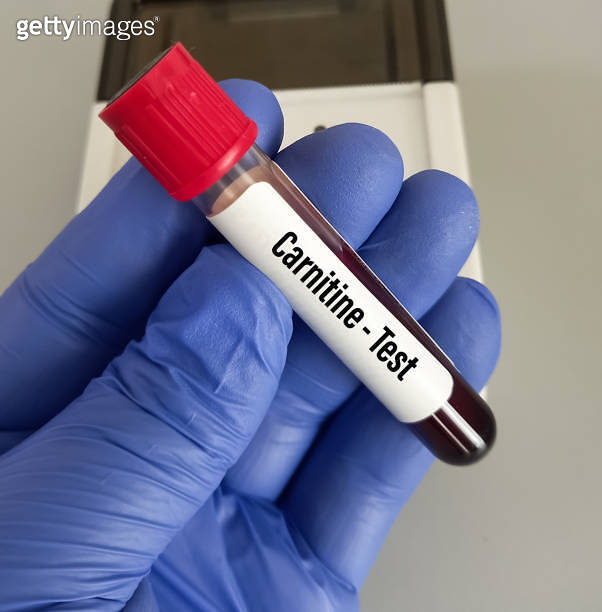 Scientist hold blood sample for Carnitine blood test, Carnitine helps
