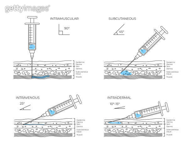 Types of injections. Guide to injecting vaccines into skin. Medical ...