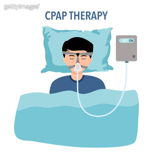 CPAP therapy is a treatment for obstructive sleep apnea. A CPAP machine