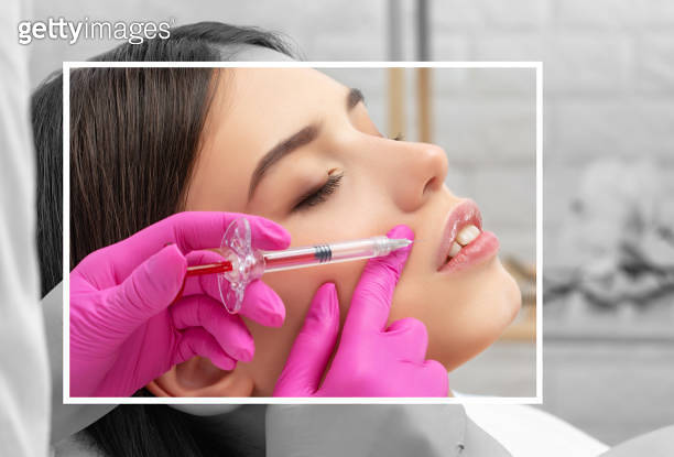 Piptum Injection Injections for lips augmentation anti wrinkle injections on the face of ...