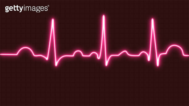 Normal heartbeat line on electrocardiogram (Sinus rhythm). ECG. EKG ...