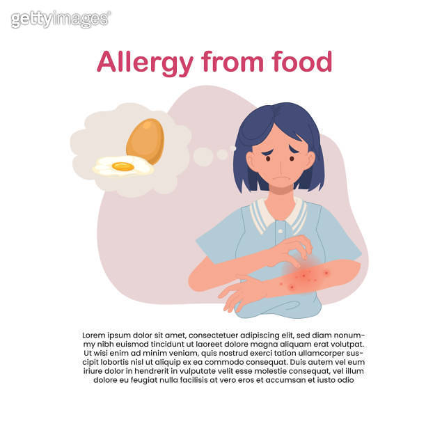 egg Allergy Reaction. Woman with Itchy Red Rash on Arm. Allergic Skin