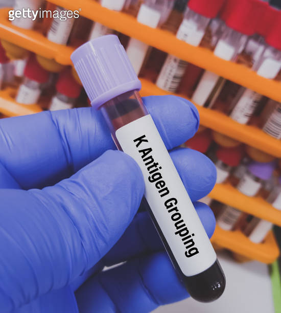 Technician hold blood sample for K antigen (Capsular polysaccharide