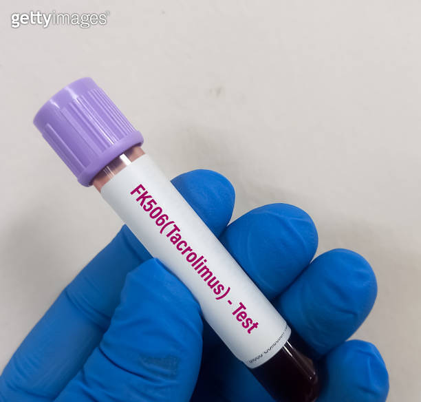 Blood sample for FK506 (Tacrolimus) level test, immunosuppressive drug