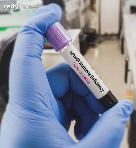 Blood sample for Growth hormone deficiency test to diagnosis Growth ...