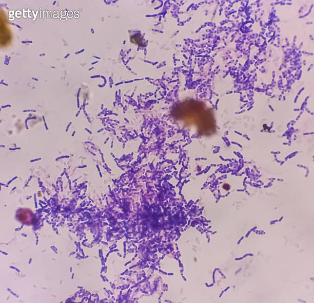 Yeast Infection; Budding yeast and pseudohyphae of Candida albicans