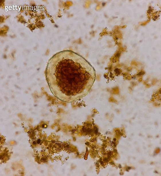 Giardia lamblia cysts and Trophozoite form, muscle fiber in stool examination. 이미지 (1457285061