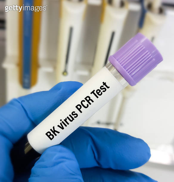 Blood sample for Real time PCR BK virus test, 이미지 (1756107820) 게티이미지뱅크
