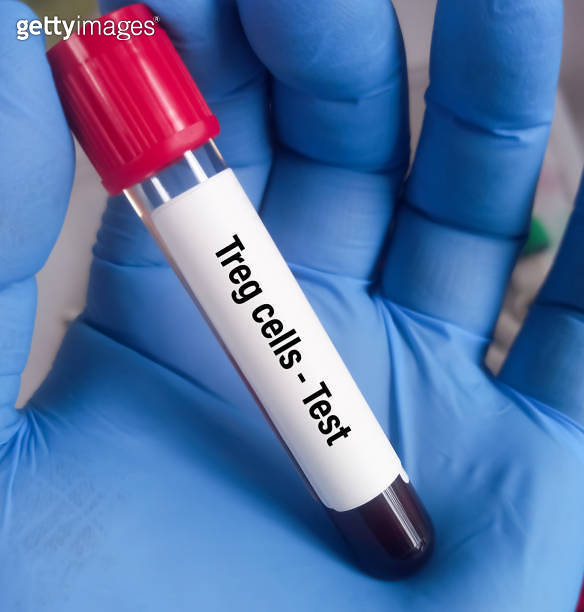 Scientist hold blood sample for Regulatory T cells or Tregs cells test ...