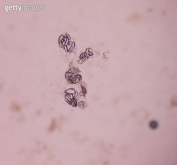 Giardia lamblia cysts and Trophozoite form, muscle fiber in stool examination, under 40X light