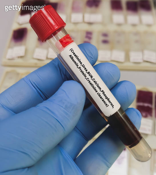 Blood sample for Creatinine, Urea, BUN, Calcium, Phosphorus, Albumin