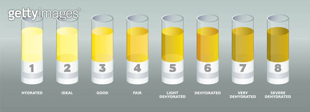 Urine color chart. Lab tubes with different urine colors samples
