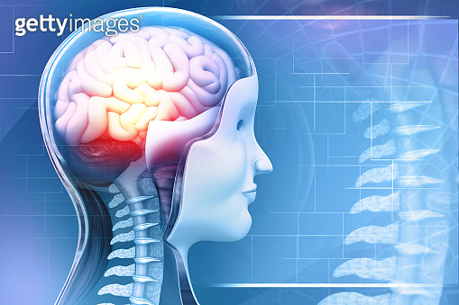 Sore Brain medically accurate illustration of a painful brain, Man with a headache ...