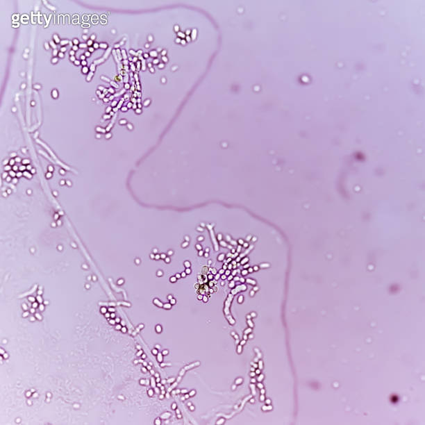 Photomicrograph Fungal colony, skin scraping for fungus test 이미지