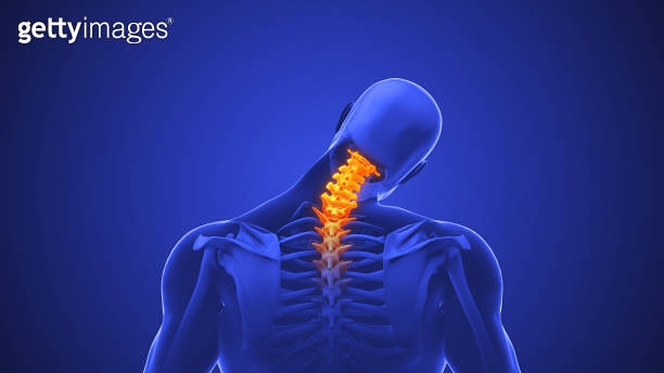 Neck Photo Animation Medical animation for neck discomfort 이미지 (2105910134) - 게티이미지뱅크